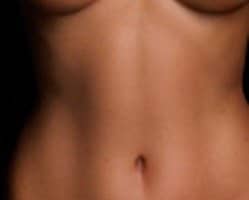 Slider image (4) Dr. Gustavo Yanez - Obesity Surgeon